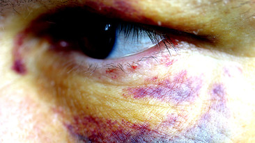 Give Me a Voice: 04/03/2009