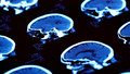 All in the Mind: Tue, 08 Dec 2009