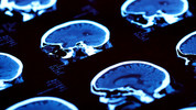 All in the Mind: Tue, 08 Dec 2009